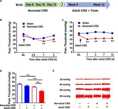 Small-Conductance Ca2+-Activated K+ Channel 2 in the Dorsal Horn of Spinal Cord Participates in Visceral Hypersensitivity in Rats